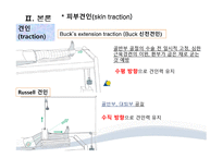간호학 골절의 비수술적 관리-13