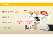 간호학 조산의 정의 원인 증상 간호원 리간호 사정-4